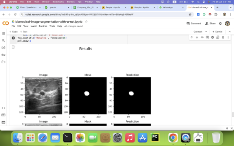 medical image